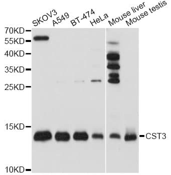 CST3 / Cystatin C Antibody