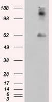 LIPG / Endothelial Lipase Antibody (clone OTI6E11)