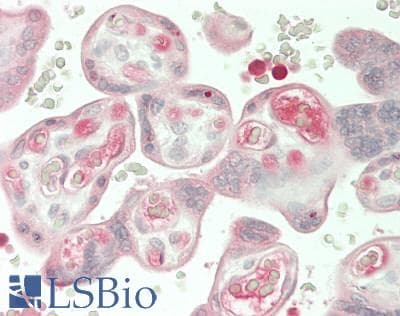 IHC-plus™ Angiogenin / ANG Antibody