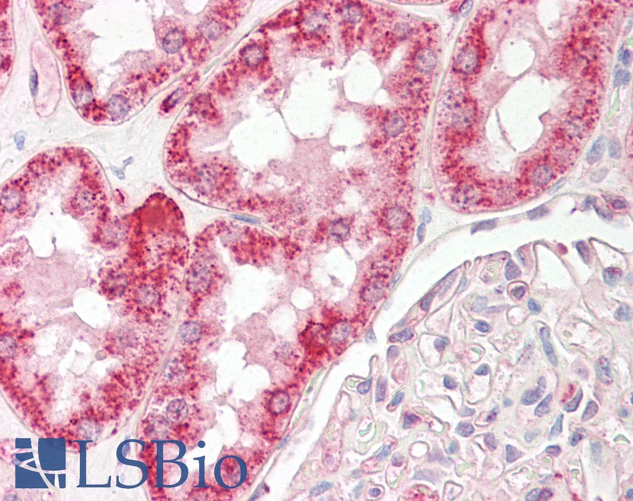 Polyclonal Rabbit anti-Human MT-ND6 Antibody (C-Terminus, IHC, WB)