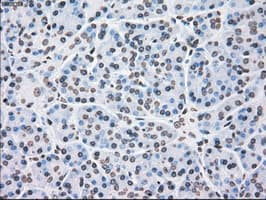 PLK1 / PLK-1 Antibody (clone OTI5C1)