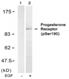 Polyclonal Rabbit anti-Human PR / Progesterone Receptor Antibody (IHC, IF, WB)