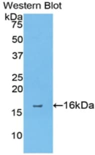 ANXA4 / Annexin IV Antibody (aa36-157)