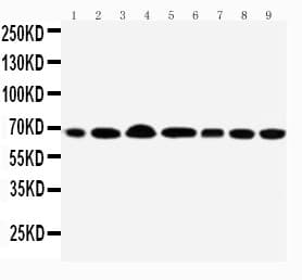 Polyclonal Rabbit anti-Human DDX5 Antibody (aa566-580, IHC, WB)