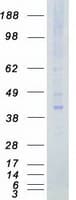 Human TSSK2 Protein (Recombinant Myc-DDK (Flag))