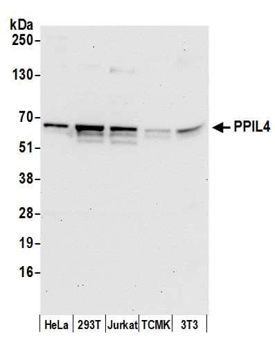 Polyclonal Rabbit anti-Human PPIL4 Antibody (aa375-425, WB)