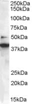 IHC-plus™ SH3GLB1 / Bif / Endophilin B1 Antibody (aa373-386)