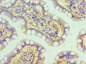 HYAL3 Antibody (aa198-417)