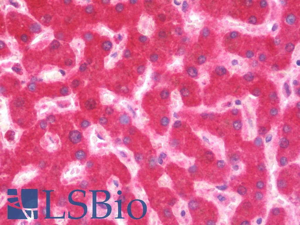 IHC-plus™ ALDH3A2 Antibody (aa166-400)