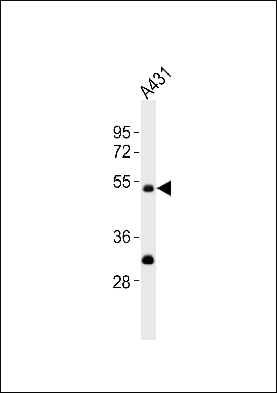 KRT13 / CK13 / Cytokeratin 13 Antibody