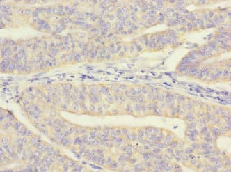 Polyclonal Rabbit anti-Human MRPL12 Antibody (IHC)