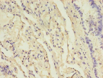Polyclonal Rabbit anti-Human B3GNT5 Antibody (IHC)