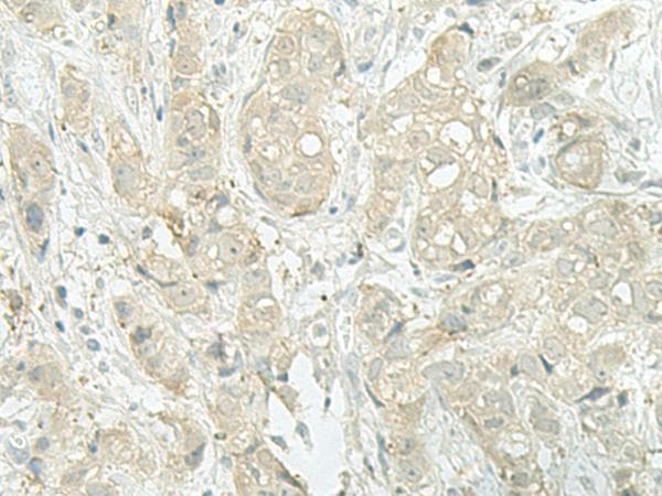 XTP4 / C17orf37 Antibody