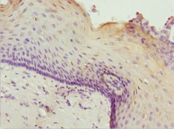 Polyclonal Rabbit anti-Human ZNF187 Antibody (IHC, WB)