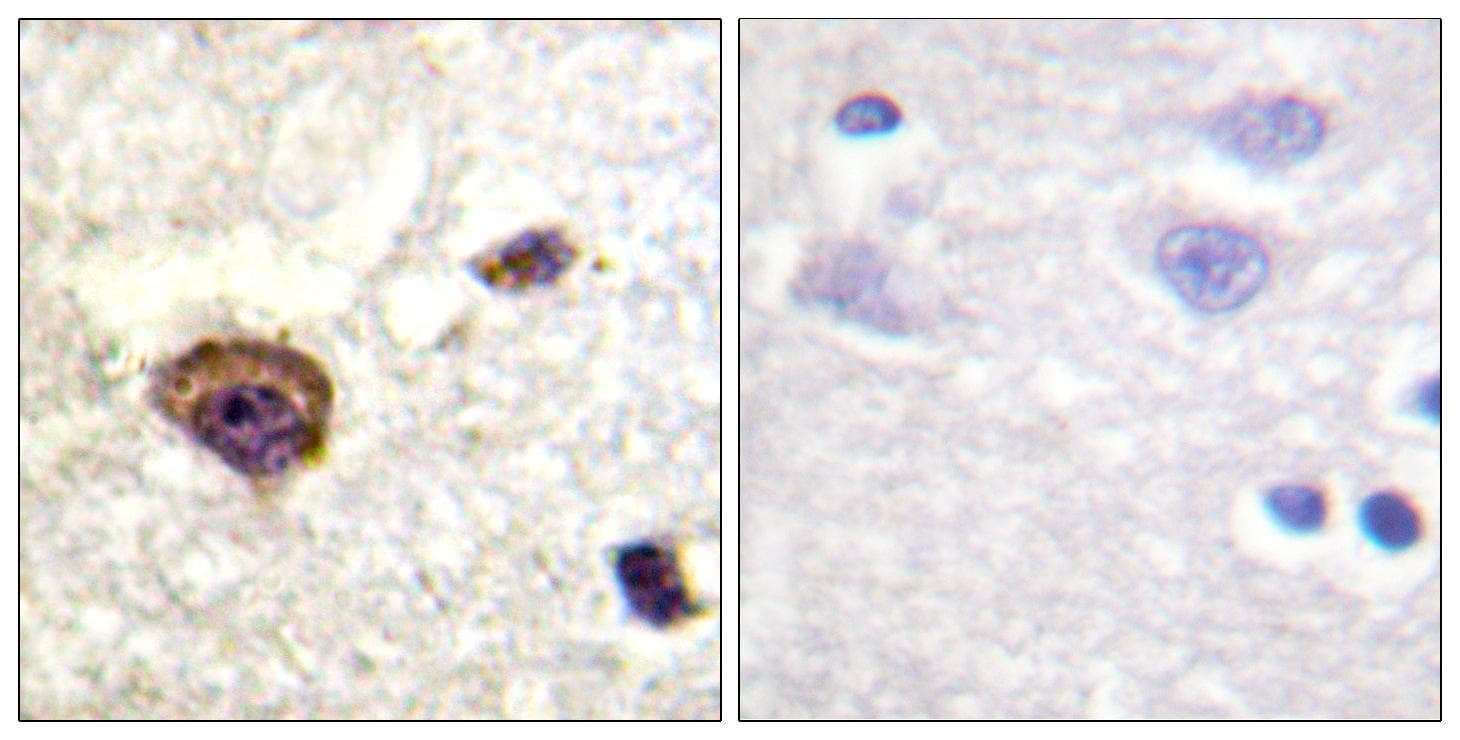 PRKCQ / PKC-Theta Antibody (phospho-Thr538)