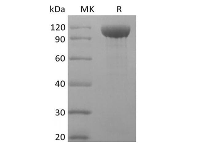 Rhesus monkey ANGPT2 / Angiopoietin-2 Protein (Recombinant Fc, C-terminus)