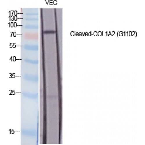 Polyclonal Rabbit anti-Human COL1A2 / Collagen I Alpha 2 Antibody (1020-1100 aa, N-terminal, WB)