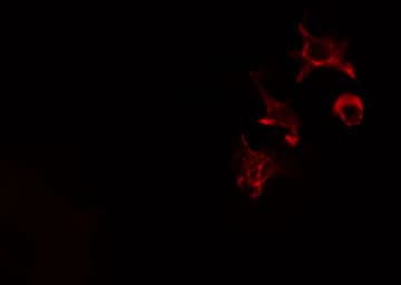SH2B2 / APS Antibody