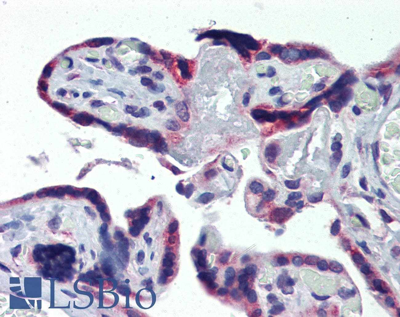 IHC-plus™ Polyclonal Rabbit anti-Human AAK1 Antibody (IHC, WB)