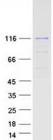 Human DIS3L Protein (Recombinant Myc-DDK (Flag))