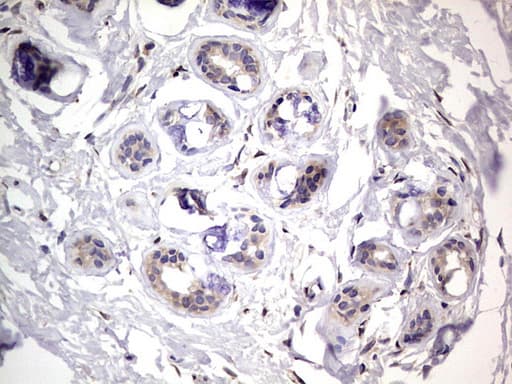 PRX-1 / PRRX1 Antibody (clone OTI1E10)