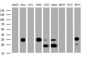 PPT1 / CLN1 Antibody (clone OTI1F10)