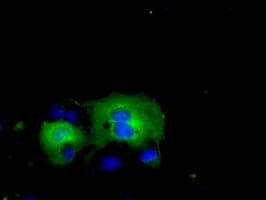 Monoclonal Mouse anti-Human ACAT2 Antibody (clone OTI1G6, IHC, IF, WB)