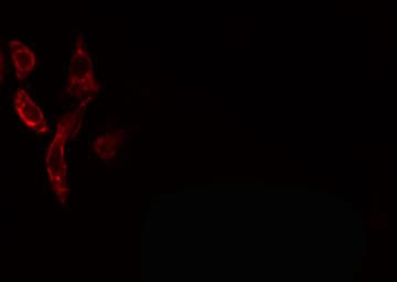 Vasohibin 1 / VASH1 Antibody