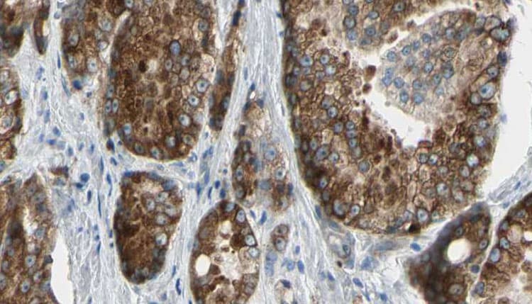 ATP12A Antibody (aa81-109)