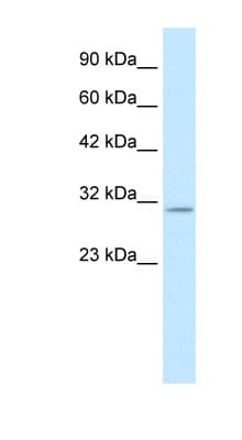 KCNIP4 / KCHIP4 Antibody (aa27-76)