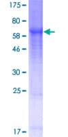Human KLHDC1 Protein (Recombinant GST)