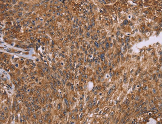 Polyclonal Rabbit anti-Human PPIB / Cyclophilin B Antibody (IHC, WB)