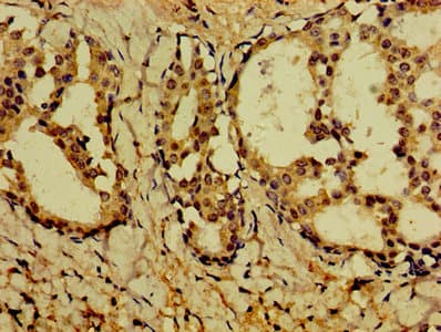 PVALB / Parvalbumin Antibody (aa2-110)