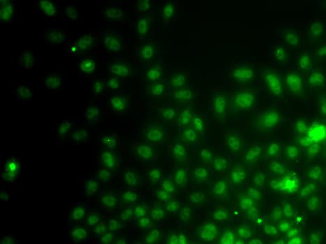 Polyclonal Rabbit anti-Human IWS1 Antibody (IHC, IF, WB)