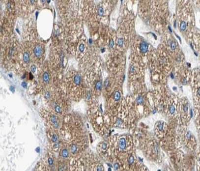 Polyclonal Rabbit anti-Human NUB1 Antibody (IHC, IF, WB)