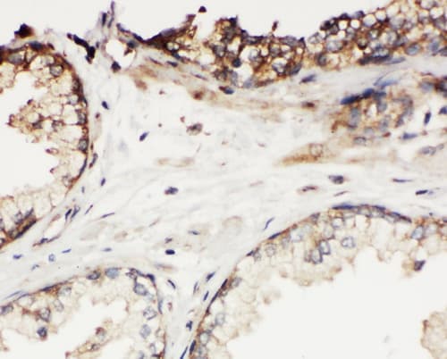 Polyclonal Rabbit anti-Human KLK11 / Kallikrein 11 Antibody (aa233-250, IHC, WB)