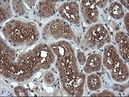 TCL / RHOJ Antibody (clone OTI1C8)
