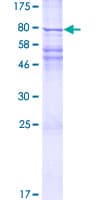 Human GGTLA1 / GGT5 Protein (Recombinant GST)