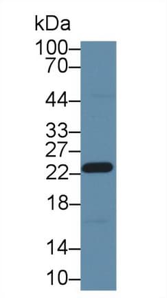 GSTP1 / GST Pi Antibody (aa1-210, APC)