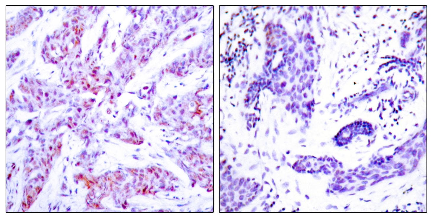 ATF4 Antibody (p245)