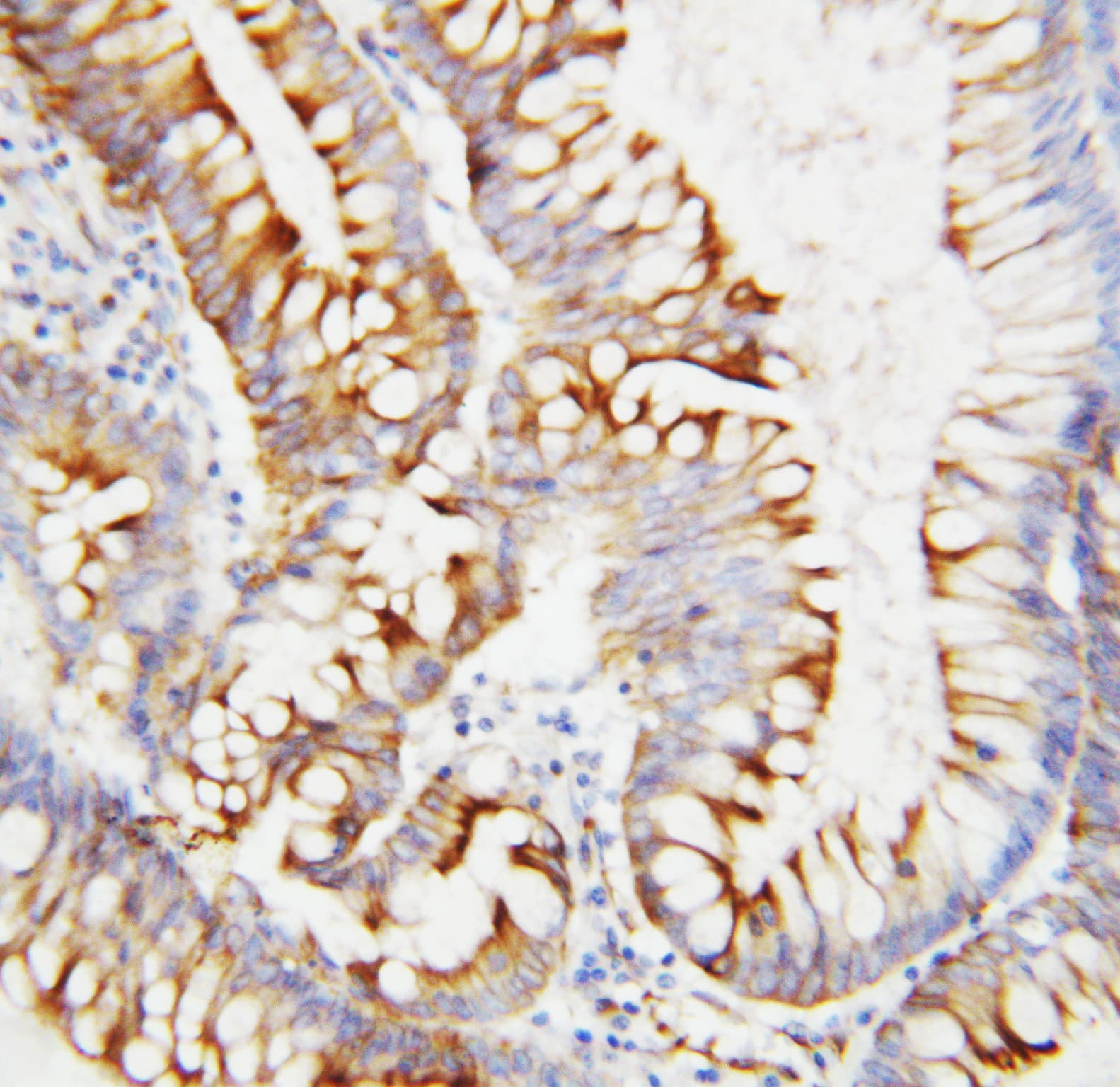 Polyclonal Rabbit anti-Human Osteonectin / SPARC Antibody (aa284-303, IHC, WB)