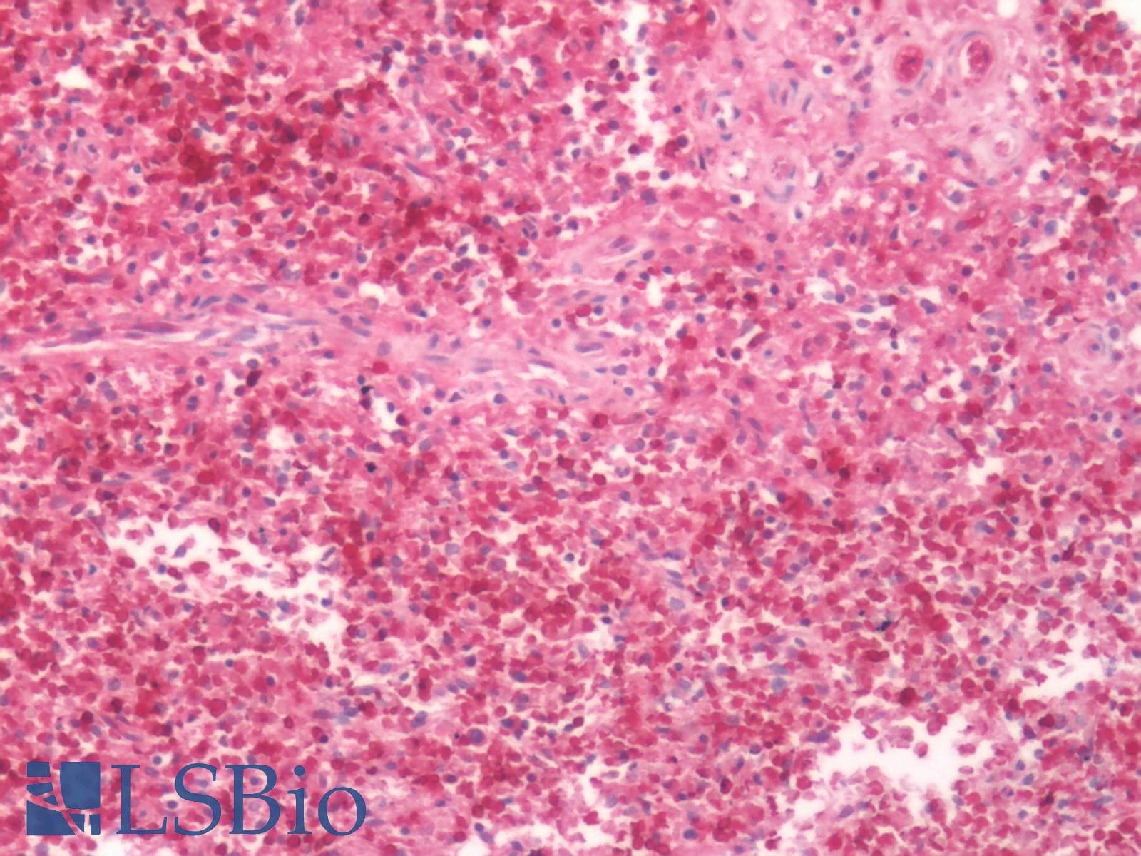 PathPlus™ Polyclonal Rabbit anti-Human FPR2 / FPRL1 Antibody (Extracellular Domain, IHC)