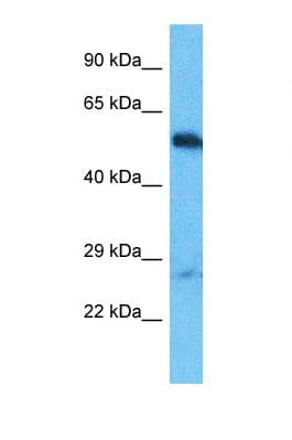 Polyclonal Rabbit anti-Human OTUD1 Antibody (C-Terminus, WB)