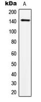 Polyclonal Rabbit anti-Human TRPS1 Antibody (N-Terminus, IHC, WB)