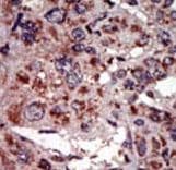 Polyclonal Rabbit anti-Human DGKA Antibody (aa598-628, IHC, WB)