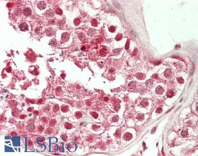 IHC-plus™ Polyclonal Rabbit anti-Human MBTPS1 / S1P Antibody (IHC, WB)