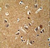 DAGLA Antibody (aa317-345)