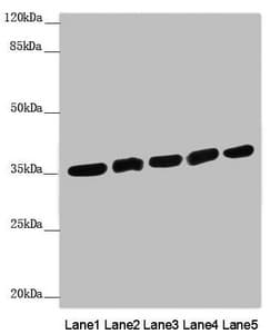 CARP / ANKRD1 Antibody
