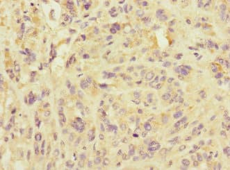 IMMP2L Antibody