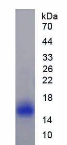 Rat CAV1 / Caveolin 1 Protein (Recombinant His)